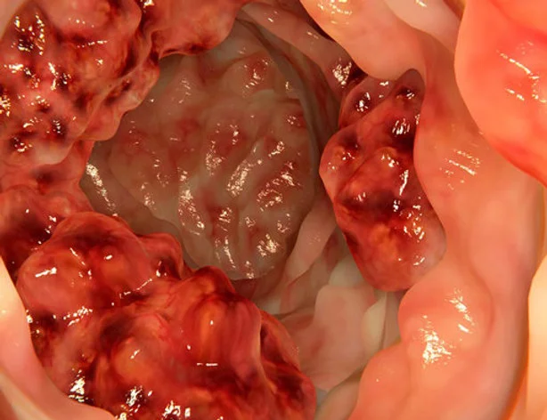 b43608_07f892baa792425b999f6604f2c4902c~mv2