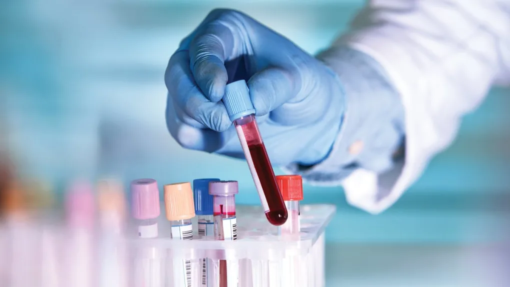 CR-Health-InlineHero-Best-Six-Important-Blood-Tests-0124